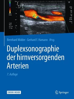 Abbildung von Widder / Hamann | Duplexsonographie der hirnversorgenden Arterien | 7. Auflage | 2018 | beck-shop.de