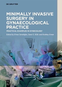 Abbildung von Saridogan / Kilic | Minimally Invasive Surgery in Gynecological Practice | 1. Auflage | 2020 | beck-shop.de