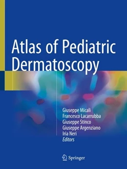 Abbildung von Micali / Lacarrubba | Atlas of Pediatric Dermatoscopy | 1. Auflage | 2018 | beck-shop.de