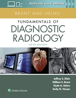 Abbildung von Klein / Vinson | Brant and Helms' Fundamentals of Diagnostic Radiology | 5. Auflage | 2018 | beck-shop.de