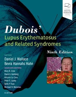 Abbildung von Wallace / Hahn | Dubois' Lupus Erythematosus and Related Syndromes | 9. Auflage | 2018 | beck-shop.de
