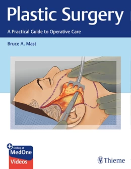 Abbildung von Mast | Plastic Surgery: A Practical Guide to Operative Care | 1. Auflage | 2021 | beck-shop.de