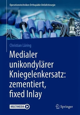 Abbildung von Lüring | Medialer unikondylärer Kniegelenkersatz: zementiert, fixed Inlay | 1. Auflage | 2018 | beck-shop.de