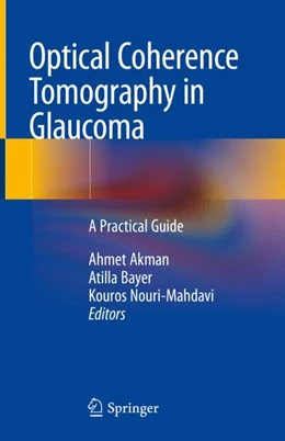 Abbildung von Akman / Bayer | Optical Coherence Tomography in Glaucoma | 1. Auflage | 2018 | beck-shop.de