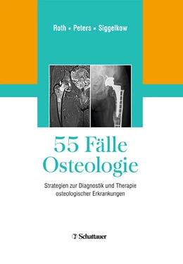 Abbildung von Roth / Peters | 55 Fälle Osteologie | 1. Auflage | 2018 | beck-shop.de