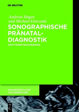 Abbildung von Hagen / Entezami | Sonographische Pränataldiagnostik | 1. Auflage | 2018 | beck-shop.de