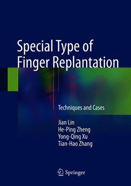 Abbildung von Lin / Zheng | Special Type of Finger Replantation | 1. Auflage | 2018 | beck-shop.de