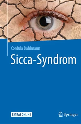 Abbildung von Dahlmann | Sicca-Syndrom | 1. Auflage | 2020 | beck-shop.de