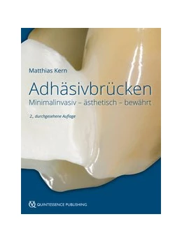 Abbildung von Kern | Adhäsivbrücken | 2. Auflage | 2018 | beck-shop.de