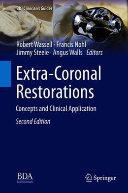 Abbildung von Wassell / Nohl | Extra-Coronal Restorations | 2. Auflage | 2018 | beck-shop.de