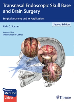 Abbildung von Stamm | Transnasal Endoscopic Skull Base and Brain Surgery | 2. Auflage | 2019 | beck-shop.de