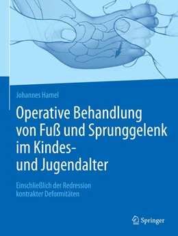 Abbildung von Hamel | Operative Behandlung von Fuß und Sprunggelenk im Kindes- und Jugendalter | 1. Auflage | 2018 | beck-shop.de
