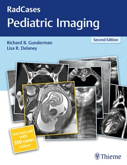 Abbildung von Gunderman / Delaney | RadCases Plus Q&A Pediatric Imaging | 2. Auflage | 2019 | beck-shop.de