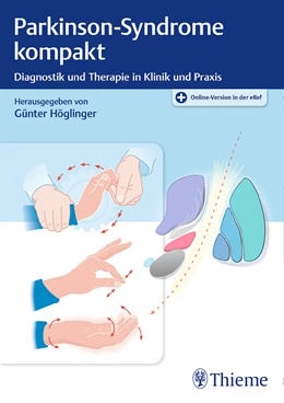 Abbildung von Höglinger | Parkinson-Syndrome kompakt | 1. Auflage | 2018 | beck-shop.de