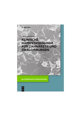 Abbildung von Sucker | Klinische Hämostaseologie für Zahnärzte und Oralchirurgen | 1. Auflage | 2019 | beck-shop.de