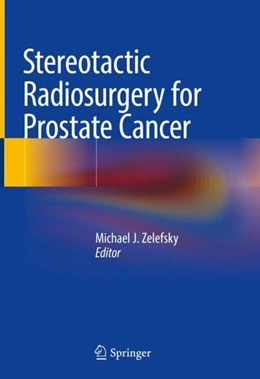 Abbildung von Zelefsky | Stereotactic Radiosurgery for Prostate Cancer | 1. Auflage | 2018 | beck-shop.de