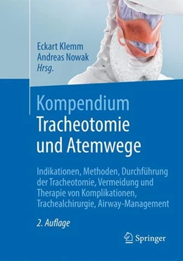 Abbildung von Klemm / Nowak | Kompendium Tracheotomie und Atemwege | 2. Auflage | 2018 | beck-shop.de