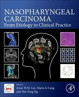 Abbildung von Lee / Ng | Nasopharyngeal Carcinoma | 1. Auflage | 2019 | beck-shop.de