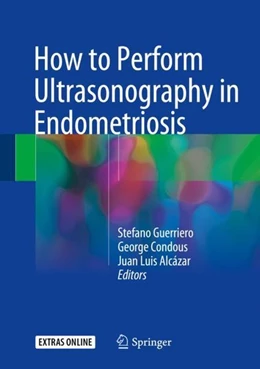 Abbildung von Guerriero / Condous | How to Perform Ultrasonography in Endometriosis | 1. Auflage | 2018 | beck-shop.de