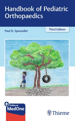 Abbildung von Sponseller | Handbook of Pediatric Orthopaedics | 3. Auflage | 2019 | beck-shop.de