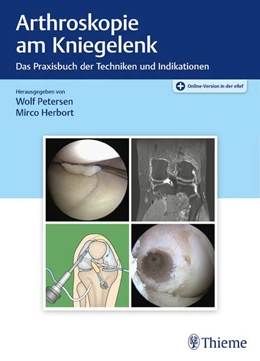 Abbildung von Petersen / Herbort | Arthroskopie am Kniegelenk | 1. Auflage | 2020 | beck-shop.de