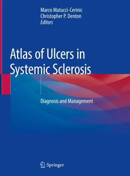 Abbildung von Matucci-Cerinic / Denton | Atlas of Ulcers in Systemic Sclerosis | 1. Auflage | 2018 | beck-shop.de