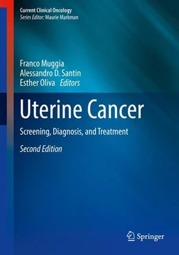 Abbildung von Muggia / Santin | Uterine Cancer | 2. Auflage | 2018 | beck-shop.de