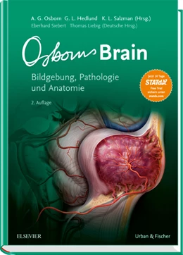 Abbildung von Osborn / Hedlund | Osborn's Brain | 2. Auflage | 2019 | beck-shop.de