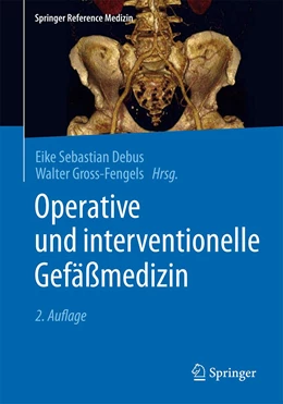 Abbildung von Debus / Gross-Fengels | Operative und interventionelle Gefäßmedizin | 2. Auflage | 2020 | beck-shop.de