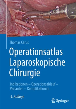 Abbildung von Carus | Operationsatlas Laparoskopische Chirurgie | 4. Auflage | 2024 | beck-shop.de