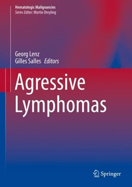 Abbildung von Lenz / Salles | Aggressive Lymphomas | 1. Auflage | 2018 | beck-shop.de