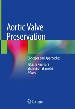 Abbildung von Kunihara / Takanashi | Aortic Valve Preservation | 1. Auflage | 2019 | beck-shop.de