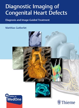 Abbildung von Gutberlet | Diagnostic Imaging of Congenital Heart Defects | 1. Auflage | 2019 | beck-shop.de