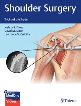 Abbildung von Dines / Gulotta | Shoulder Surgery | 1. Auflage | 2019 | beck-shop.de