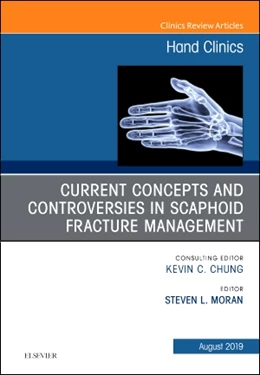 Abbildung von Moran | Current Concepts and Controversies in Scaphoid Fracture Management, An Issue of Hand Clinics | 1. Auflage | 2019 | beck-shop.de