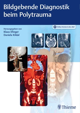 Abbildung von Efinger / Kildal | Bildgebende Diagnostik beim Polytrauma | 1. Auflage | 2019 | beck-shop.de