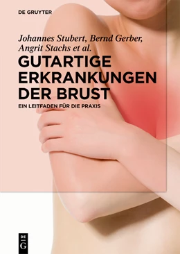 Abbildung von Stubert / Gerber | Gutartige Erkrankungen der Brust | 1. Auflage | 2019 | beck-shop.de