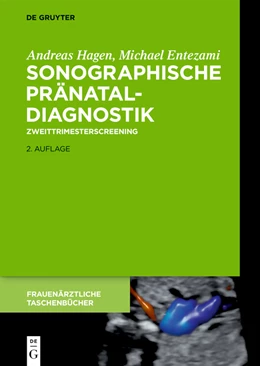 Abbildung von Entezami / Hagen | Sonographische Pränataldiagnostik | 1. Auflage | 2019 | beck-shop.de