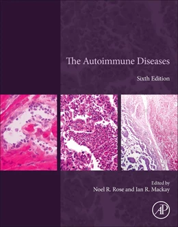 Abbildung von Gershwin / Tsokos | The Autoimmune Diseases | 6. Auflage | 2019 | beck-shop.de