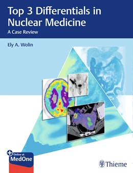 Abbildung von Wolin | Top 3 Differentials in Nuclear Medicine | 1. Auflage | 2019 | beck-shop.de