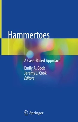 Abbildung von Cook | Hammertoes | 1. Auflage | 2019 | beck-shop.de