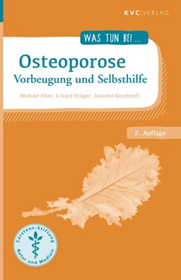 Abbildung von Elies / Krüger | Osteoporose | 2. Auflage | 2019 | beck-shop.de