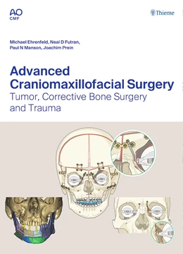Abbildung von Ehrenfeld / Futran | Advanced Craniomaxillofacial Surgery | 1. Auflage | 2020 | beck-shop.de