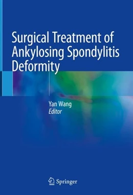 Abbildung von Wang | Surgical Treatment of Ankylosing Spondylitis Deformity | 1. Auflage | 2019 | beck-shop.de
