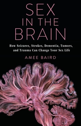 Abbildung von Baird | Sex in the Brain | 1. Auflage | 2020 | beck-shop.de