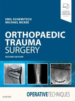 Abbildung von Schemitsch / McKee | Operative Techniques: Orthopaedic Trauma Surgery | 2. Auflage | 2019 | beck-shop.de