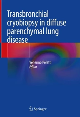 Abbildung von Poletti | Transbronchial cryobiopsy in diffuse parenchymal lung disease | 1. Auflage | 2019 | beck-shop.de