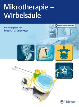 Abbildung von Grönemeyer | Mikrotherapie - Wirbelsäule | 1. Auflage | 2023 | beck-shop.de