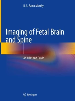 Abbildung von Rama Murthy | Imaging of Fetal Brain and Spine | 1. Auflage | 2019 | beck-shop.de