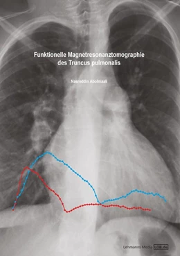 Abbildung von Abolmaali | Funktionelle Magnetresonanztomographie des Truncus pulmonalis | 1. Auflage | 2014 | beck-shop.de
